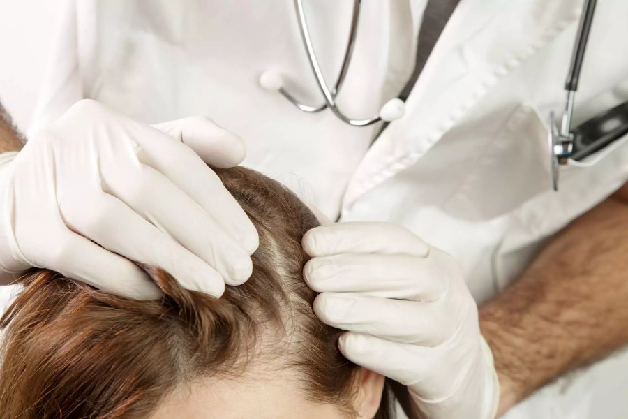 Прыщи на коже головы у мужчин и женщин: причины, лечение | Capillum Clinic