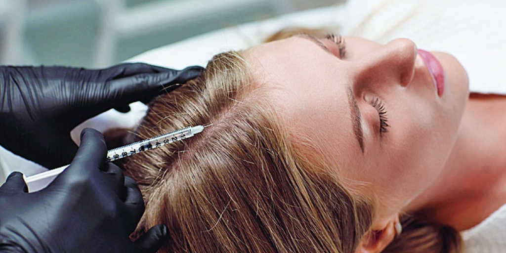 Плазмотерапия волосистой части головы в Москве